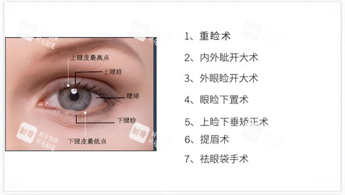 眼综合整形包含的部分项目演示图