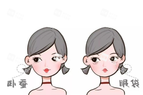 卧蚕、眼袋卡通对比图