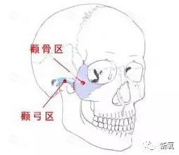颧骨骨骼图
