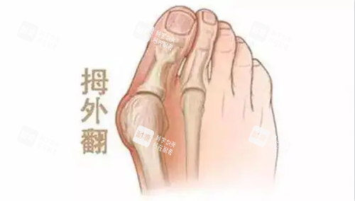 大脚骨示意图