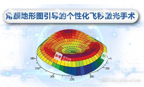 绿飞秒示意图