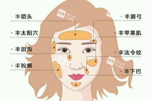 自体脂肪面部填充卡通图一览