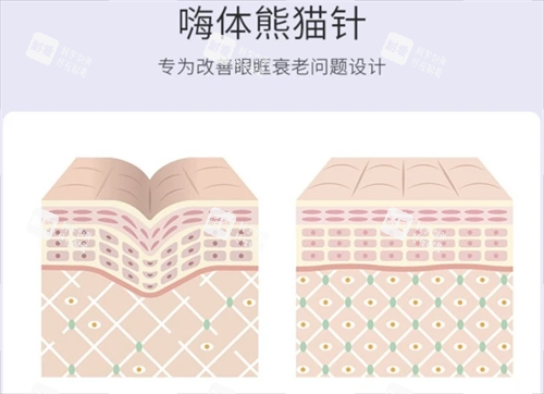 嗨体熊猫针皮肤组织动画展示
