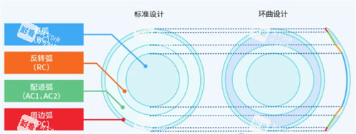 角膜塑形镜不同设计对比