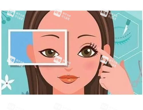 开眼角明显对比结果图