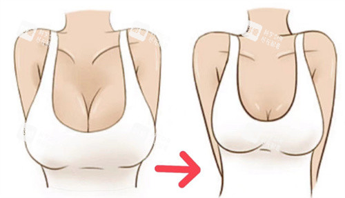 巨乳缩小卡通