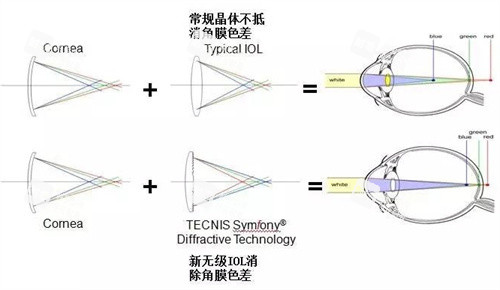 新无极人工晶体的优点