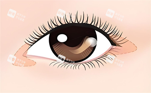 开内外眼角的卡通图