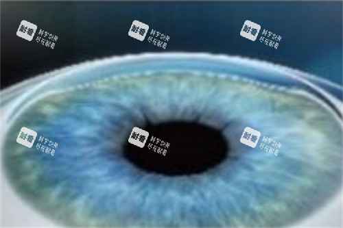 全飞秒手术结束 全飞秒手术结束