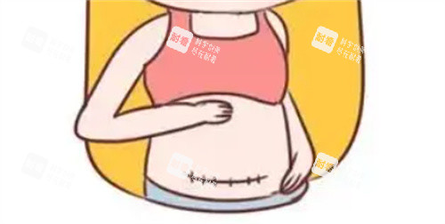 腹部疤痕