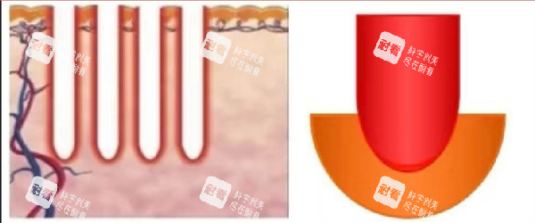 二氧化碳点阵激光