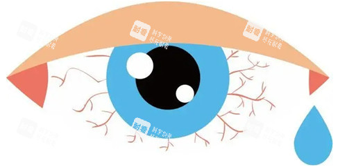 干眼症卡通图片