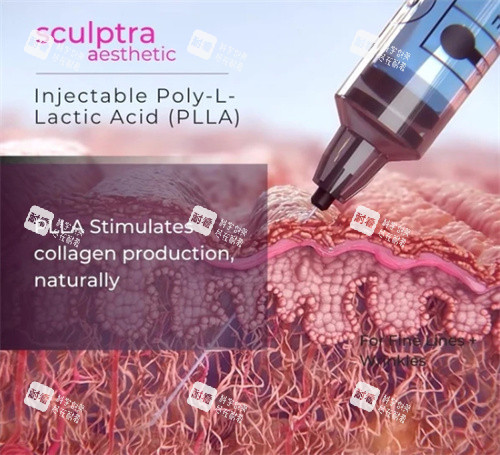 塑妍萃注射深度 塑妍萃注射深度