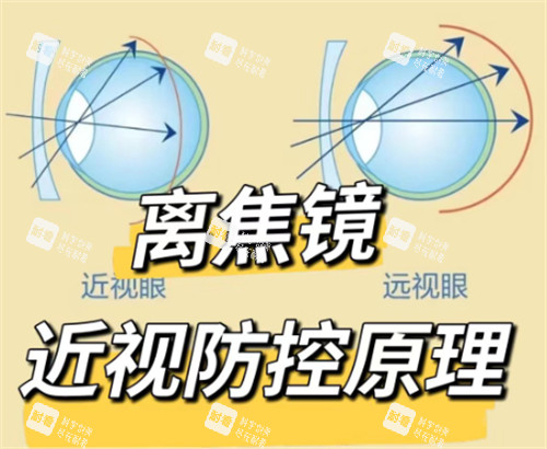 离焦镜片防控原理