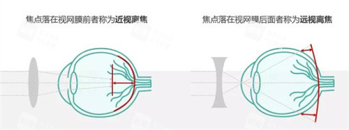 离焦是什么