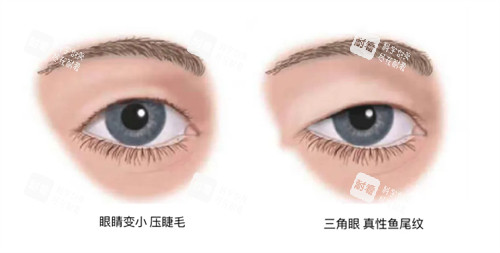 需要提眉的状况