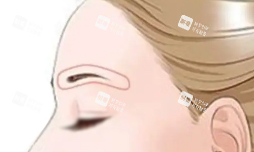 眉弓部位展示
