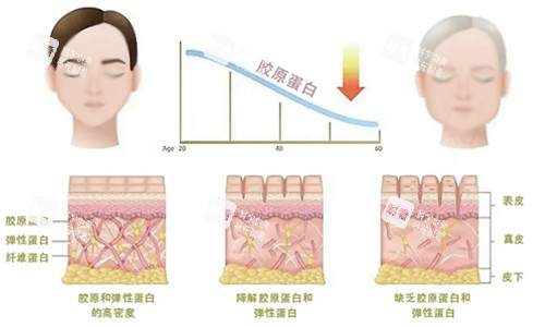 胶原蛋白流失