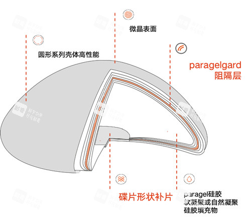 优丝俪胸假体优势分享 优丝俪胸假体优势分享