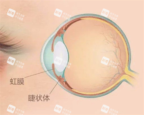 虹膜位置示意图