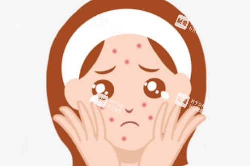 脸上长痘卡通图