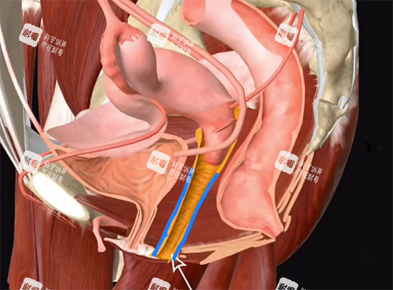 阴道紧缩针动画原理 阴道紧缩针动画原理