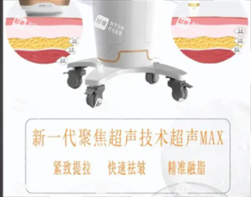 超声max作用