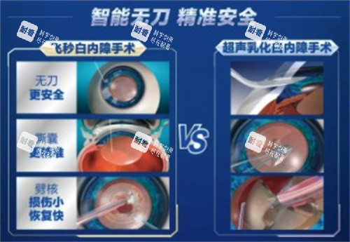 爱尔眼科白内障手术