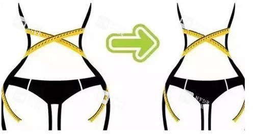 腰腹部吸脂对比图 腰腹部吸脂对比图