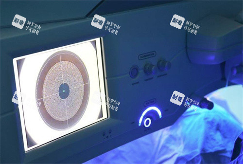 近视眼手术 近视眼手术