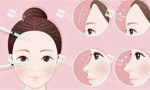 面部注射对比图 面部注射对比图