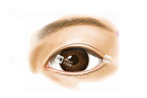 真实双眼皮示意图