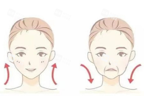 面部脂肪填充卡通对比图