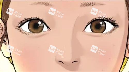 自然双眼皮 自然双眼皮