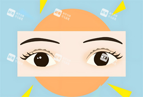 双眼皮睁开图 双眼皮睁开图