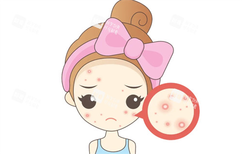 面部痘痘 面部痘痘