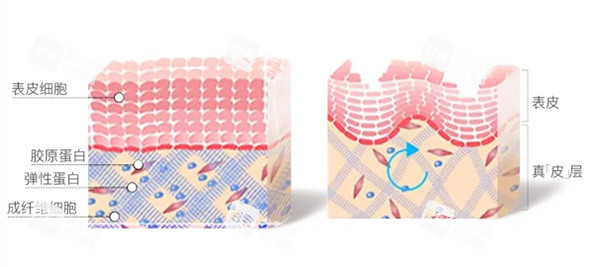 艾维岚填充皮肤示意图