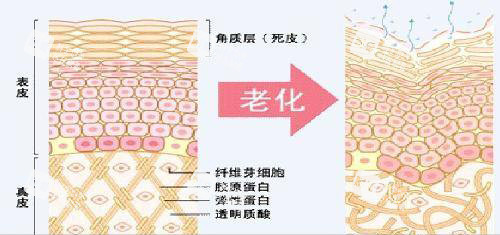皮肤老化前后内部组织形态示意图