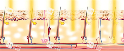 光子嫩肤作用图 光子嫩肤作用图