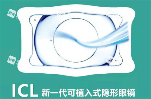 ICL介绍 ICL介绍