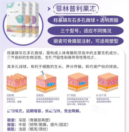 菲林普利果冻针原理