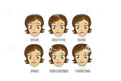 脸上皱纹