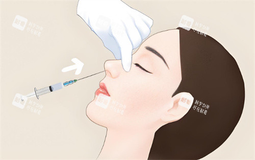 注射隆鼻