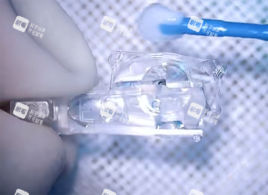 三焦晶体手术过程照片示意图 三焦晶体手术过程照片示意图