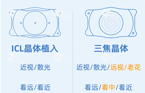 ICL和三焦晶体示意图 ICL和三焦晶体示意图