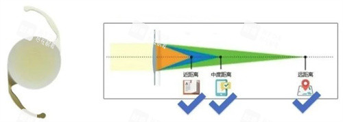 三焦晶体 三焦晶体