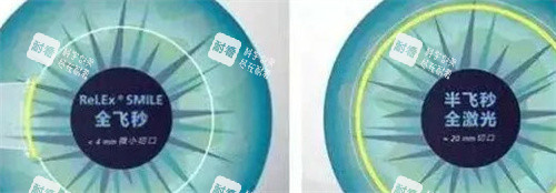 全飞秒和半飞秒 全飞秒和半飞秒