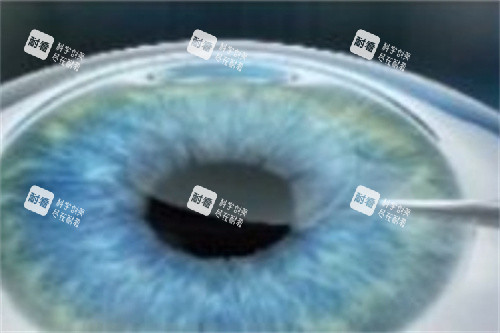 全飞秒分离基质层