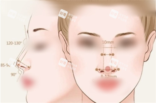 隆鼻后正面侧面展示图 隆鼻后正面侧面展示图