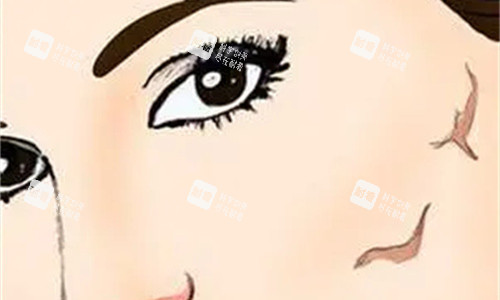 面部疤痕展示图 面部疤痕展示图